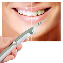Load image into Gallery viewer, Sonic Pic Plaque &amp; Stain Remover